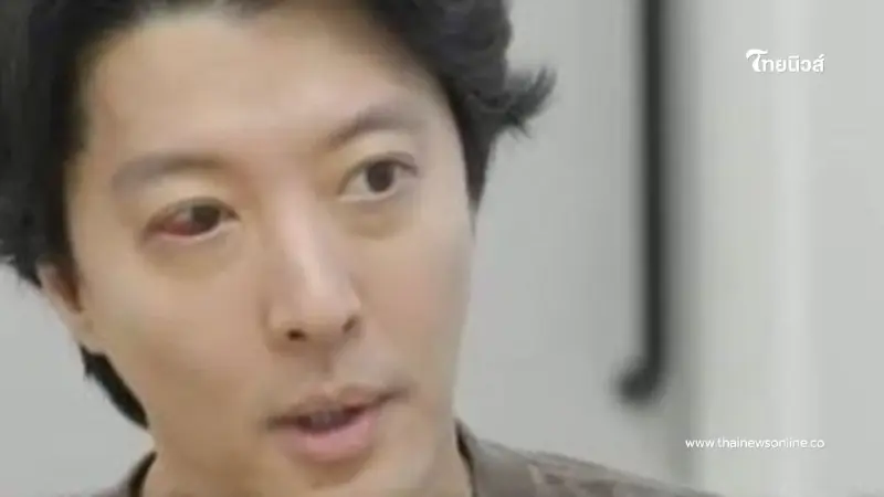 นักแสดงชื่อดัง ป่วยโรคหายาก ตาข้างหนึ่งแดง - เจ็บปวดรุนแรง