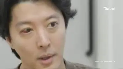 นักแสดงชื่อดัง ป่วยโรคหายาก ตาข้างหนึ่งแดง - เจ็บปวดรุนแรง
