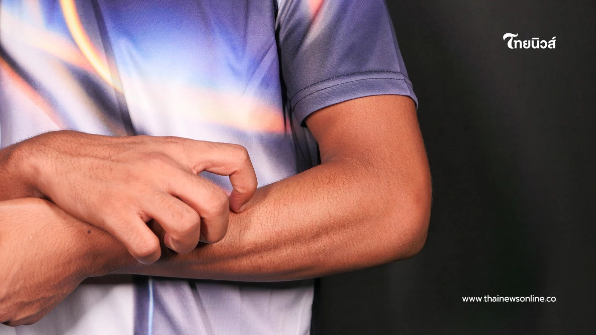 .สัญญาณเตือน 