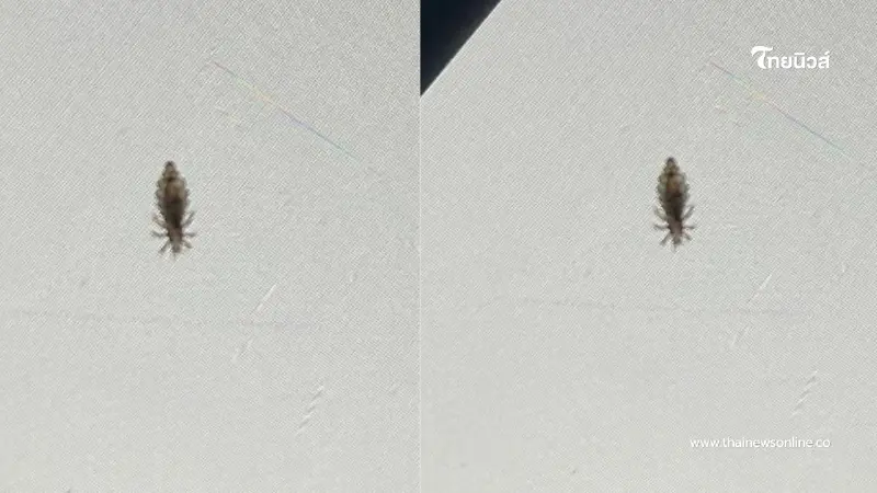 สาวคันหัว นึกว่าภูมิตก เจอความจริงชวนขนลุก สระผมบ่อยก็ไม่รอด