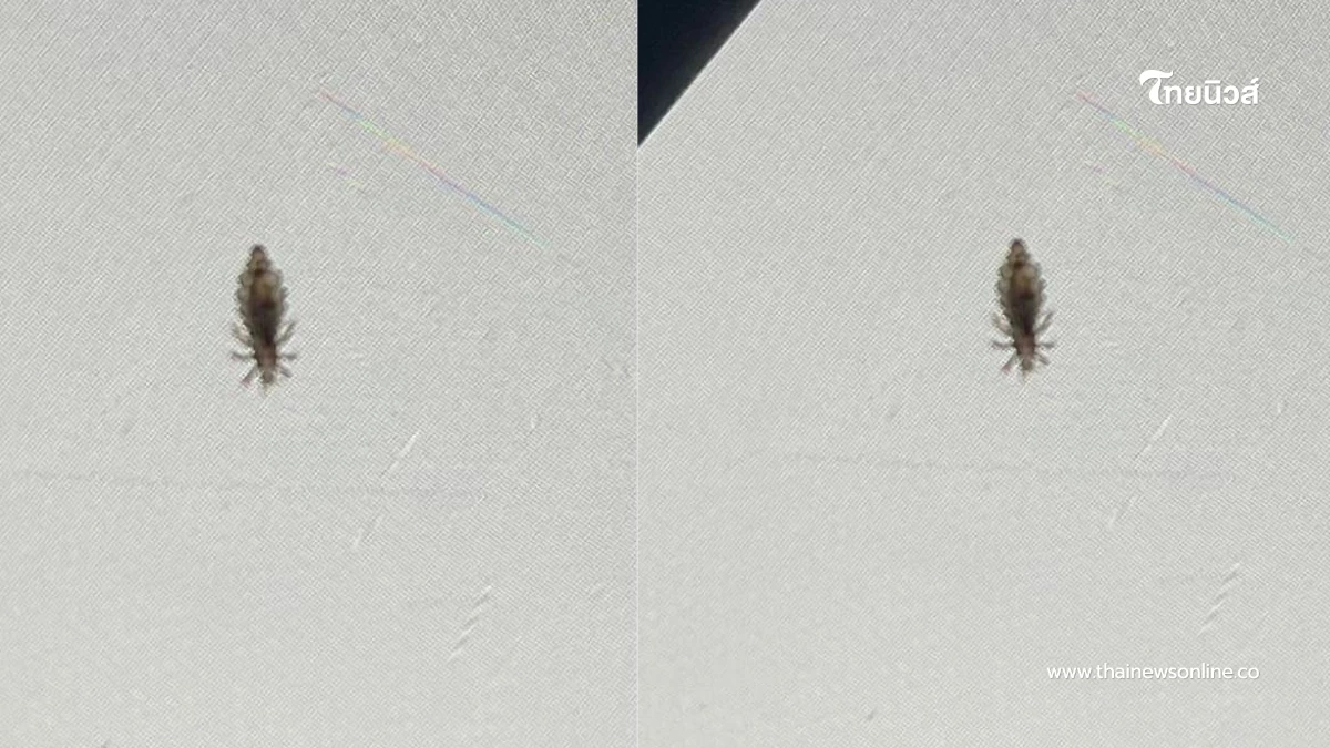 สาวคันหัว นึกว่าภูมิตก เจอความจริงชวนขนลุก สระผมบ่อยก็ไม่รอด สาวคันหัว นึกว่าภูมิตก เจอความจริงชวนขนลุก สระผมบ่อยก็ไม่รอด