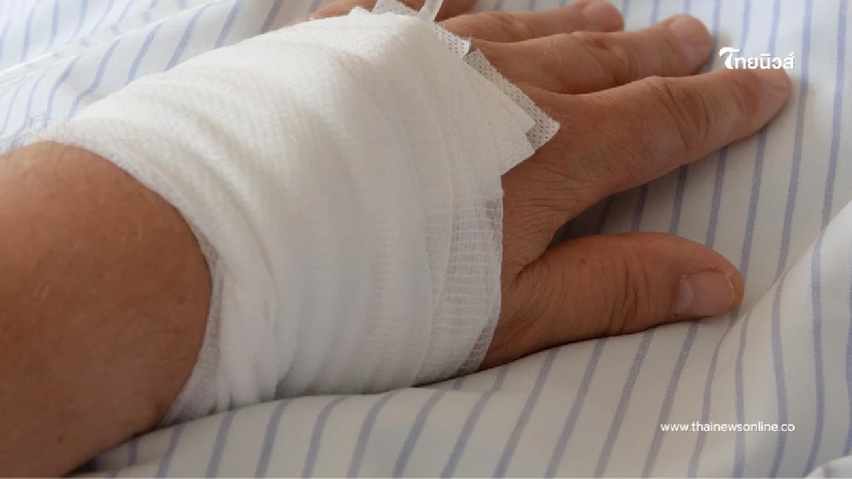 สาวพลาดแค่เรื่องเล็กๆ กลายเป็นฝันร้าย ไฟไหม้เสียโฉมทั่วตัว