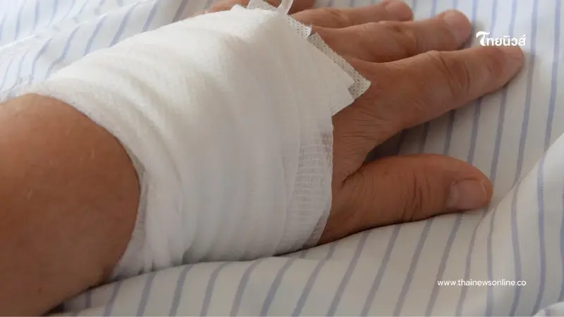 สาวพลาดแค่เรื่องเล็กๆ กลายเป็นฝันร้าย ไฟไหม้เสียโฉมทั่วตัว