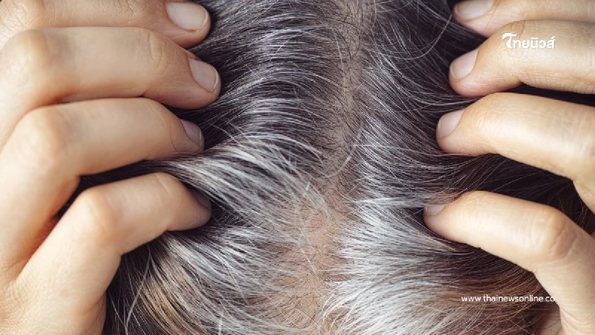 ผมหงอกก่อนวัยเกิดจากอะไร เช็ก 5 สาเหตุที่ทำให้ผมขาว ทั้งที่อายุน้อย