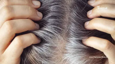 ผมหงอกก่อนวัยเกิดจากอะไร เช็ก 5 สาเหตุที่ทำให้ผมขาว ทั้งที่อายุน้อย