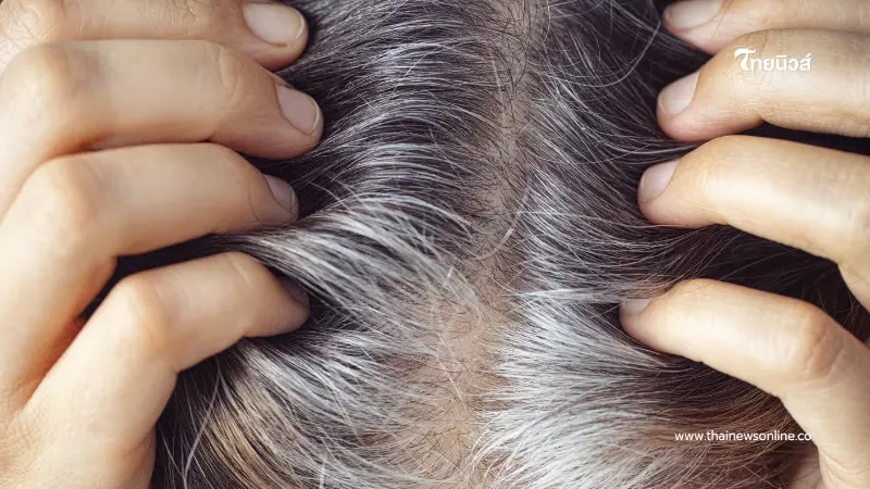 ผมหงอกก่อนวัยเกิดจากอะไร เช็ก 5 สาเหตุที่ทำให้ผมขาว ทั้งที่อายุน้อย ผมหงอกก่อนวัยเกิดจากอะไร เช็ก 5 สาเหตุที่ทำให้ผมขาว ทั้งที่อายุน้อย