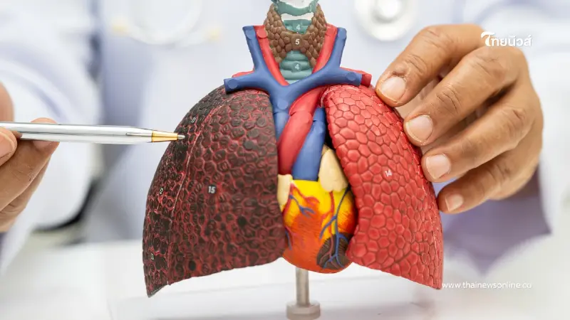 ไม่สูบก็เสี่ยง ไขข้อเท็จจริง เรื่องเข้าใจผิดเกี่ยวกับมะเร็งปอด