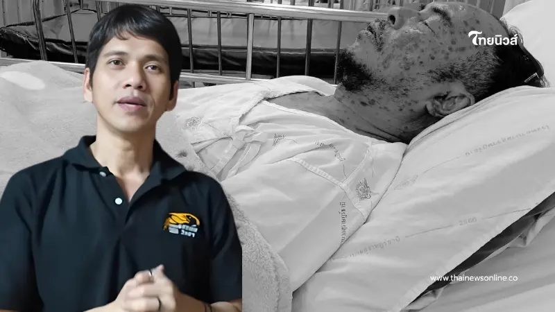 จิตอาสาจับงู ป่วยหนัก "นิค อสรพิษวิทยา" วอนช่วยหลังค่ารักษาพุ่ง