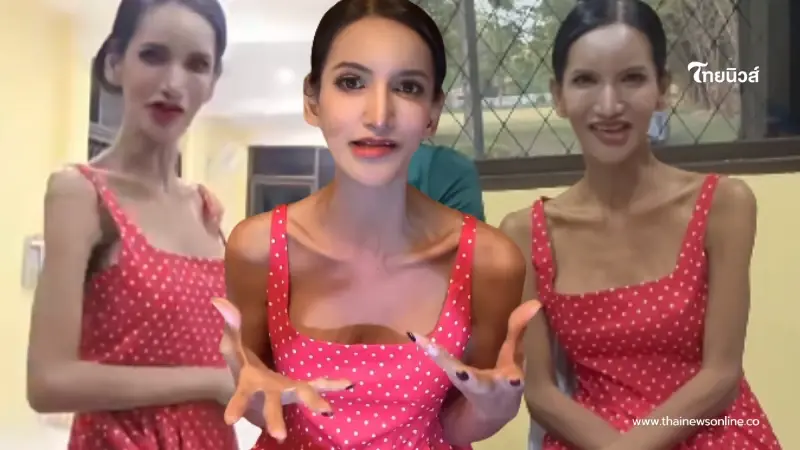 เผยอาการป่วยล่าสุด "เพชร ปากปลาร้าหน้าเป๊ะ" หลังร่างกายซูบผอม เผยอาการป่วยล่าสุด "เพชร ปากปลาร้าหน้าเป๊ะ" หลังร่างกายซูบผอม