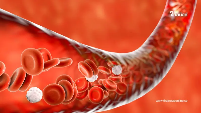 พิรุธหรือป่วย? เช็ก 6 สัญญาณสโตรก 'BEFAST' รู้ไวช่วยทัน