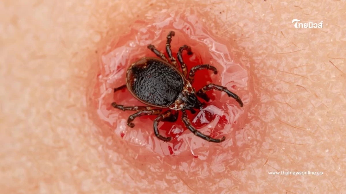 เช็ก ภัยใกล้ตัวจากเห็บกัด พบไวรัส SFTS ในไทย เสี่ยงสมองอักเสบ