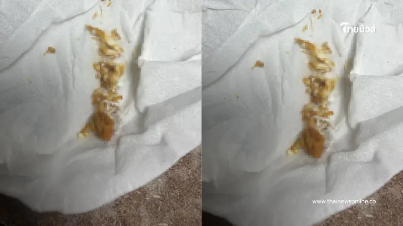 หมอเฉลยแล้ว เคสคนไข้เชื่อมีแมลงไต่ทั้งตัว แท้จริงคืออะไร