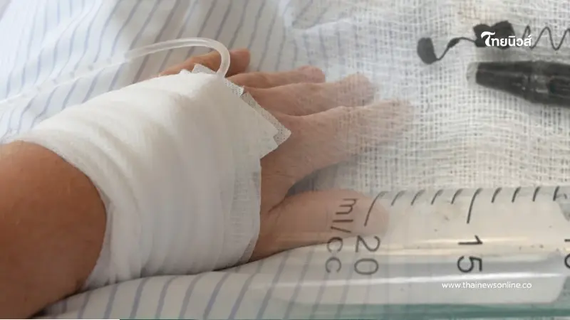 ปวดขมับเรื้อรังนานหลายปี ทนไม่ไหวไปหาหมอ พบสิ่งแปลกปลอมฝัง 13 ปี