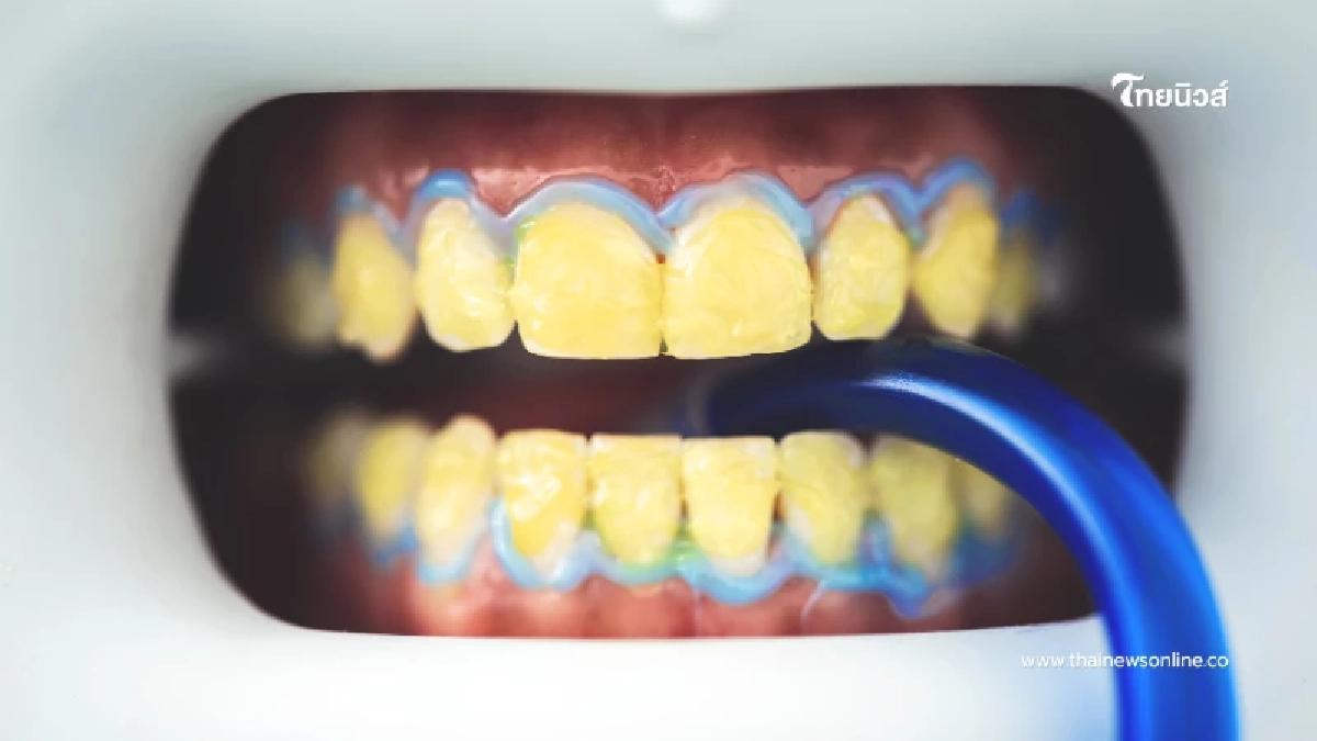 ดีอีเปิดโผสิทธิใหม่ อุด-ถอน-ผ่า ไม่จำกัดจำนวนครั้ง ใครได้บ้างเช็กเลย