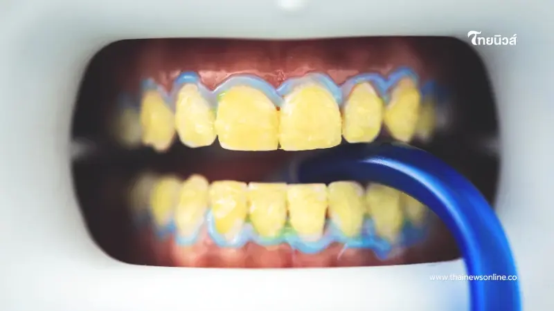 ดีอีเปิดโผสิทธิใหม่ อุด-ถอน-ผ่า ไม่จำกัดจำนวนครั้ง ใครได้บ้างเช็กเลย