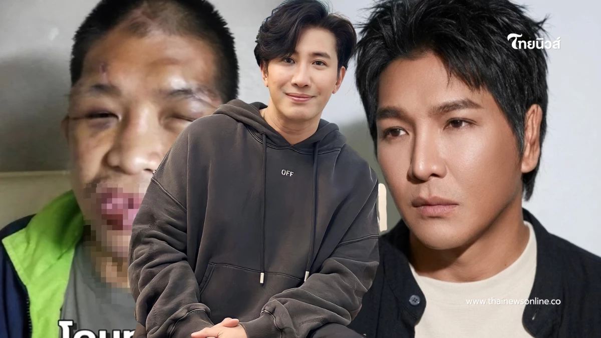 "หนุ่ม กรรชัย" โพสต์แล้ว น้องฟ้าได้ชีวิตใหม่ หลังผ่าตัด 11 ครั้ง "หนุ่ม กรรชัย" โพสต์แล้ว น้องฟ้าได้ชีวิตใหม่ หลังผ่าตัด 11 ครั้ง