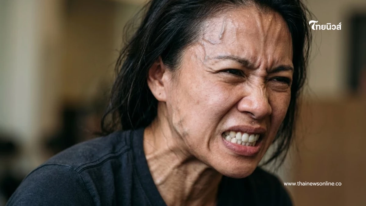 สาวเบ่งปลดทุกข์ สุดท้ายความจำเสื่อม หมอเผยสาเหตุน่ากลัวกว่าคิด