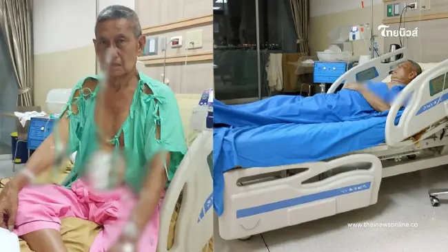 เกือบปิดตำนาน เปิดอาการ "ชาลี คดีเด็ด" หลังผ่าตัดล้างลำไส้ด่วน