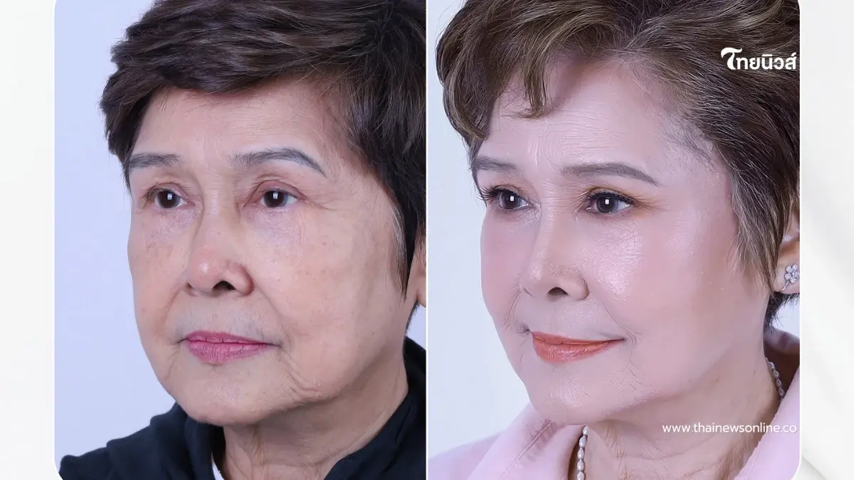 สวยย้อนวัย นักแสดงรุ่นใหญ่ เผยภาพลุคล่าสุดหลังดึงหน้า สวยย้อนวัย นักแสดงรุ่นใหญ่ เผยภาพลุคล่าสุดหลังดึงหน้า