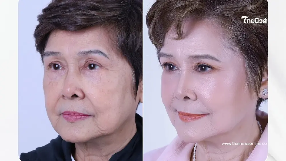 สวยย้อนวัย นักแสดงรุ่นใหญ่ เผยภาพลุคล่าสุดหลังดึงหน้า