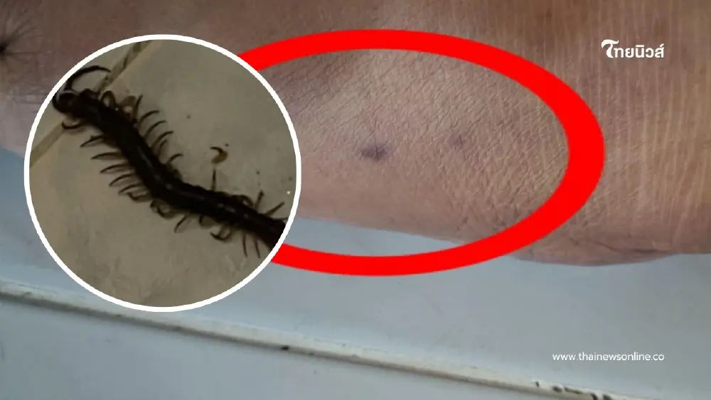 ญาติไม่ติดใจเหตุหญิงถูกตะขาบกัดดับ ใบชันสูตรระบุไม่ทราบสาเหตุ