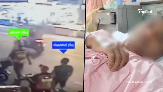 หนักมาก "คุณเอ" เผยอาการล่าสุด ไม่ใช่แค่สูญเสียอัณฑะอย่างเดียว หนักมาก "คุณเอ" เผยอาการล่าสุด ไม่ใช่แค่สูญเสียอัณฑะอย่างเดียว