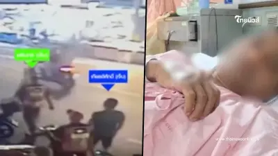 หนักมาก "คุณเอ" เผยอาการล่าสุด ไม่ใช่แค่สูญเสียอัณฑะอย่างเดียว หนักมาก "คุณเอ" เผยอาการล่าสุด ไม่ใช่แค่สูญเสียอัณฑะอย่างเดียว