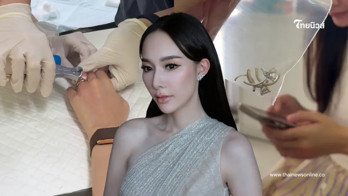 เกิดอะไรขึ้น? อุทาหรณ์คนชอบใส่แหวน หมอต้องสั่งตัดแหวนทิ้งด่วน เกิดอะไรขึ้น? อุทาหรณ์คนชอบใส่แหวน หมอต้องสั่งตัดแหวนทิ้งด่วน