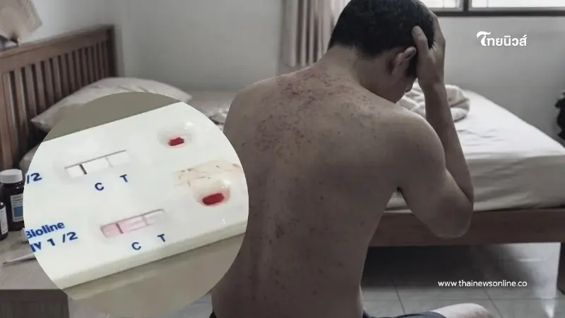 HIV ตรวจเองได้แล้ว เปิดวิธีเช็กเบื้องต้น ใครเสี่ยงเช็กด่วน HIV ตรวจเองได้แล้ว เปิดวิธีเช็กเบื้องต้น ใครเสี่ยงเช็กด่วน