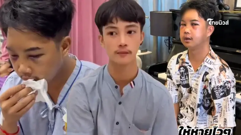 เห็นแล้วตกใจ "บอล โดเรม่อน" ใบหน้าล่าสุด หลังประสบอุบัติเหตุ เห็นแล้วตกใจ "บอล โดเรม่อน" ใบหน้าล่าสุด หลังประสบอุบัติเหตุ