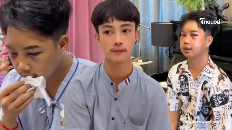 เห็นแล้วตกใจ "บอล โดเรม่อน" ใบหน้าล่าสุด หลังประสบอุบัติเหตุ